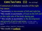 Two LECTURE on SCOLIOSIS in REGENSBURG / 10-14.05.2007