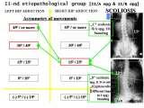 SICOT/2007/MAROCCO/Marrakech/SOSORT 2008/Athens/Recent LECTURE on scoliosis