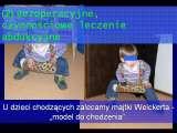 DDH/Cong.luxation of hip/LUBLIN method ot therapy/LECTURE