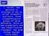 SYNDROME of CONTRACTURES-Hip Dysplasia / DDH / WryNeck/M.Blount/SCOL./LECTURES