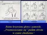 Biodra bolesne/Imperfect hips/Ureife Huften/LECTURE