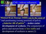 RECENT fundamental KNOWLEDGE on SCOLIOSIS/Orthop.Congress/Cairo/Egypt/LECTURE
