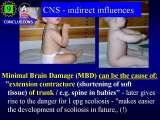 RECENT fundamental KNOWLEDGE on SCOLIOSIS/Orthop.Congress/Cairo/Egypt/LECTURE