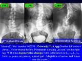 RECENT fundamental KNOWLEDGE on SCOLIOSIS/Orthop.Congress/Cairo/Egypt/LECTURE
