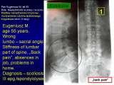 New fundamental knowledge in Paediatric Orthopaedics LECTURE / 28.02.2009