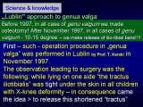 New fundamental knowledge in Paediatric Orthopaedics LECTURE / 28.02.2009