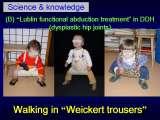 New fundamental knowledge in Paediatric Orthopaedics LECTURE / 28.02.2009