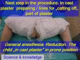 New fundamental knowledge in Paediatric Orthopaedics LECTURE / 28.02.2009