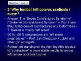 New Fundamental Knowledge on Scoliosis. SCIENCE versus OPINION / LECTURE