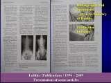 New Fundamental Knowledge on Scoliosis. SCIENCE versus OPINION / LECTURE