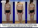 New Fundamental Knowledge on Scoliosis. SCIENCE versus OPINION / LECTURE