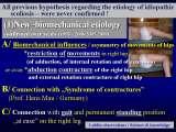 Krtkie wyjanienie ETIOLOGII SKOLIOZY tzw. IDIOPATYCZNEJ:
1/ asymetria ruchw i ustawie bioder (zwizek z ZESPOEM PRZYKURCZW opisanym przez Prof. Hansa Mau). Przykurcz odwiedzeniowy prawego biodra, czsto zgiciowy i w rotacji zewntrznej (wykrywaj nowe testy),
2/ asymetria obcie strony lewej i prawej w czasie chodzenia, asymetria czasu stania na lewej / prawej nodze (wicej na PRAWEJ),
3/ asymetria ronicia i rozwoju miednicy i krgosupa
4/ w rezultacie SKOLIOZA w trzech grupach epg i czterech typach.  
