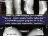 STANDING 'at free' on the right leg.Spine.Hip.Knee.Shank.LECTURE