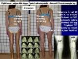 STANDING 'at free' on the right leg.Spine.Hip.Knee.Shank.LECTURE