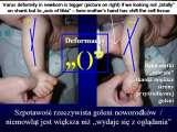 STANDING 'at free' on the right leg.Spine.Hip.Knee.Shank.LECTURE
