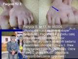 Test fleksyjny palcw stopy / Flexions test of toes LECTURE