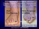 Test fleksyjny palc�w stopy / Flexions test of toes LECTURE