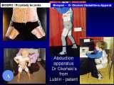 CEREBRAL PALSY, MPDZ / Mozgowe porazenie dziec. IZP. LECTURE
