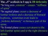 Two LECTURE on SCOLIOSIS in REGENSBURG / 10-14.05.2007