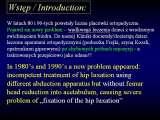 DDH/Cong.luxation of hip/LUBLIN method ot therapy/LECTURE